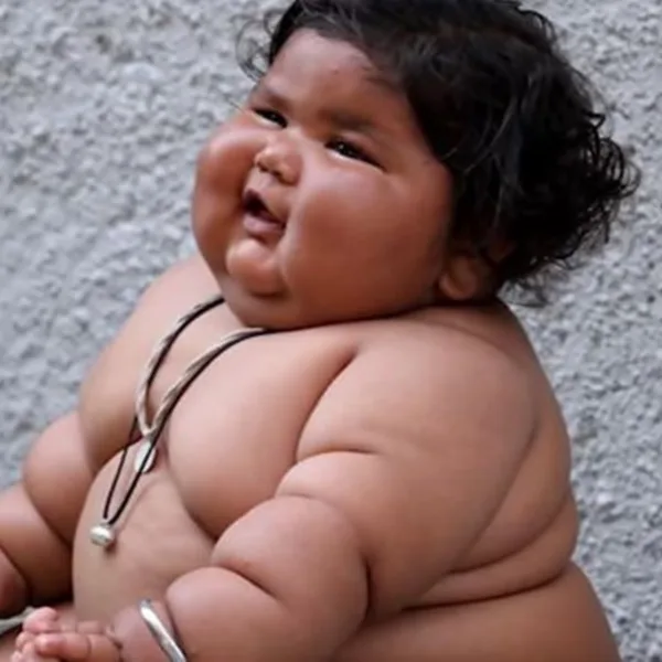 Una bebé india conmociona al mundo con su peso