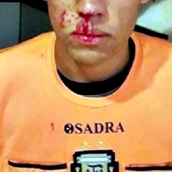 Violencia en el fútbol: trompada y cabezazo a un árbitro
