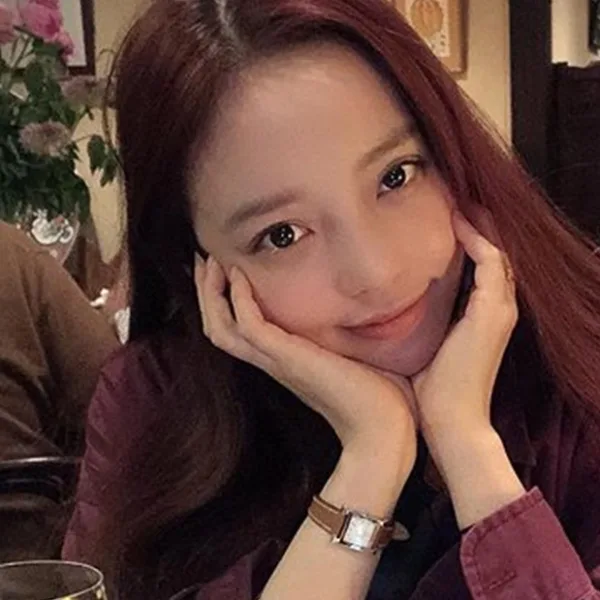 Goo Hara, estrella del K-Pop, intentó suicidarse y la encontró su manager