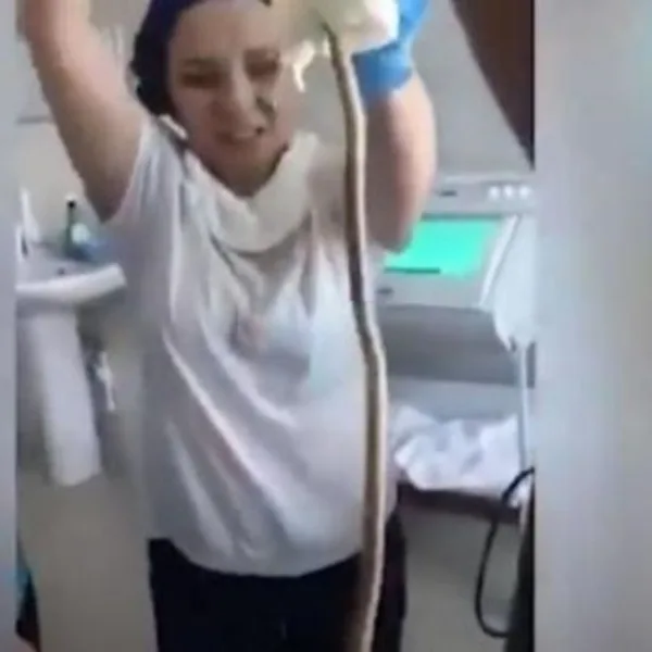 Fue al hospital porque no podía respirar y le sacaron un serpiente