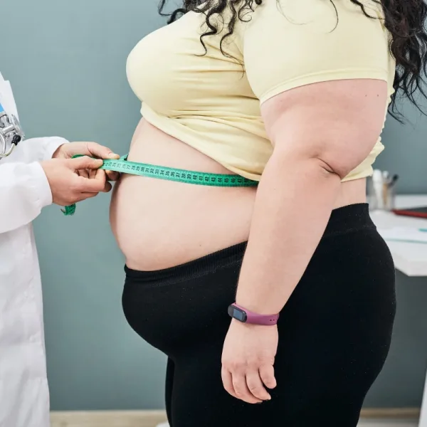 Día Mundial de la Obesidad