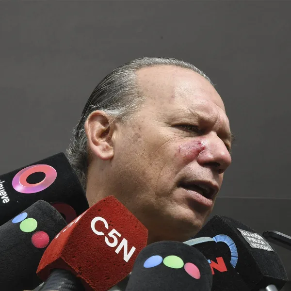 Tras la agresión a Berni, el Gobierno bonaerense apunta a la Policía de la Ciudad y a las empresas