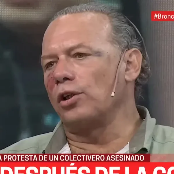 Berni aseguró que fue víctima de una "emboscada" y calificó de "llamativo" el crimen del colectivero