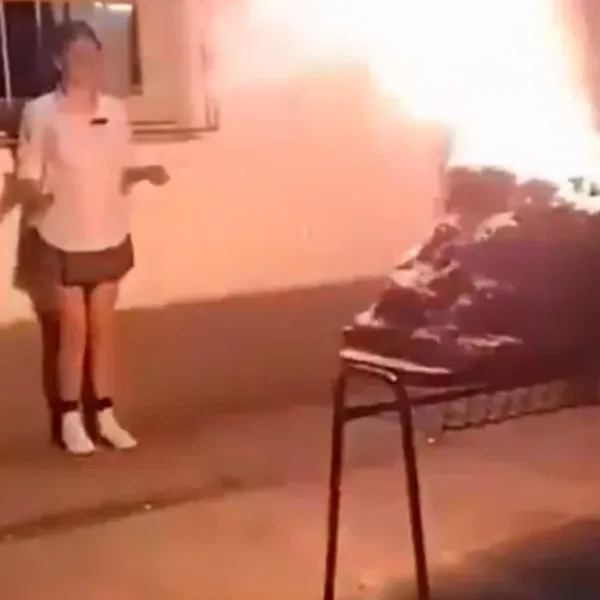 La nena herida por la explosión de la maqueta de un volcán debió ser operada otra vez 