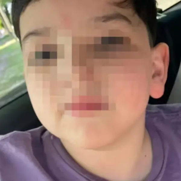 Los estudios confirmaron que Bastián sufrió lesiones cerebrales y cervicales