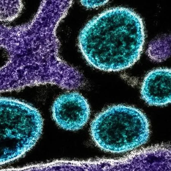 Qué es el virus Nipah y cómo se transmite