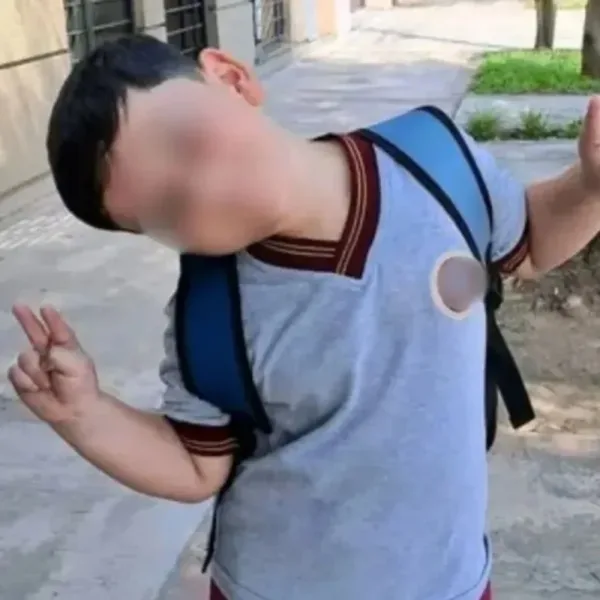 Bastian fue operado nuevamente y ya lleva más de 10 intervenciones quirúrgicas