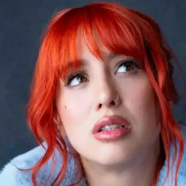 Flor Vigna contó que tiene un quiste en la cabeza: "El doctor me anunció la muerte"